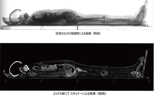 ミイラ画像