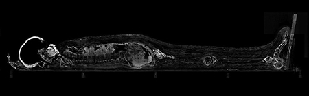 ミイラのＣＴ画像