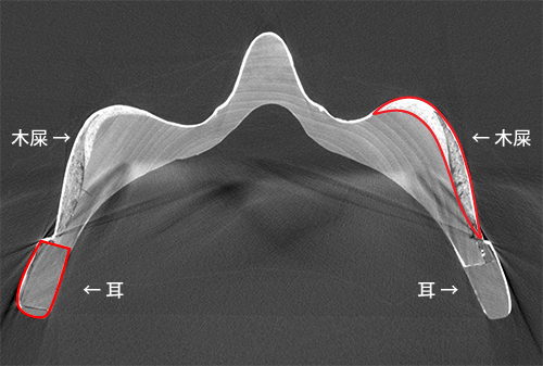 鼻のあたりの断面図（CT画像）